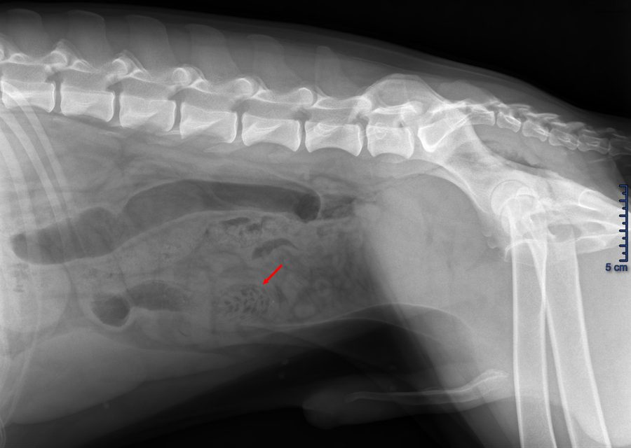 Radiographie